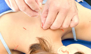 恵比寿・白金鍼灸治療